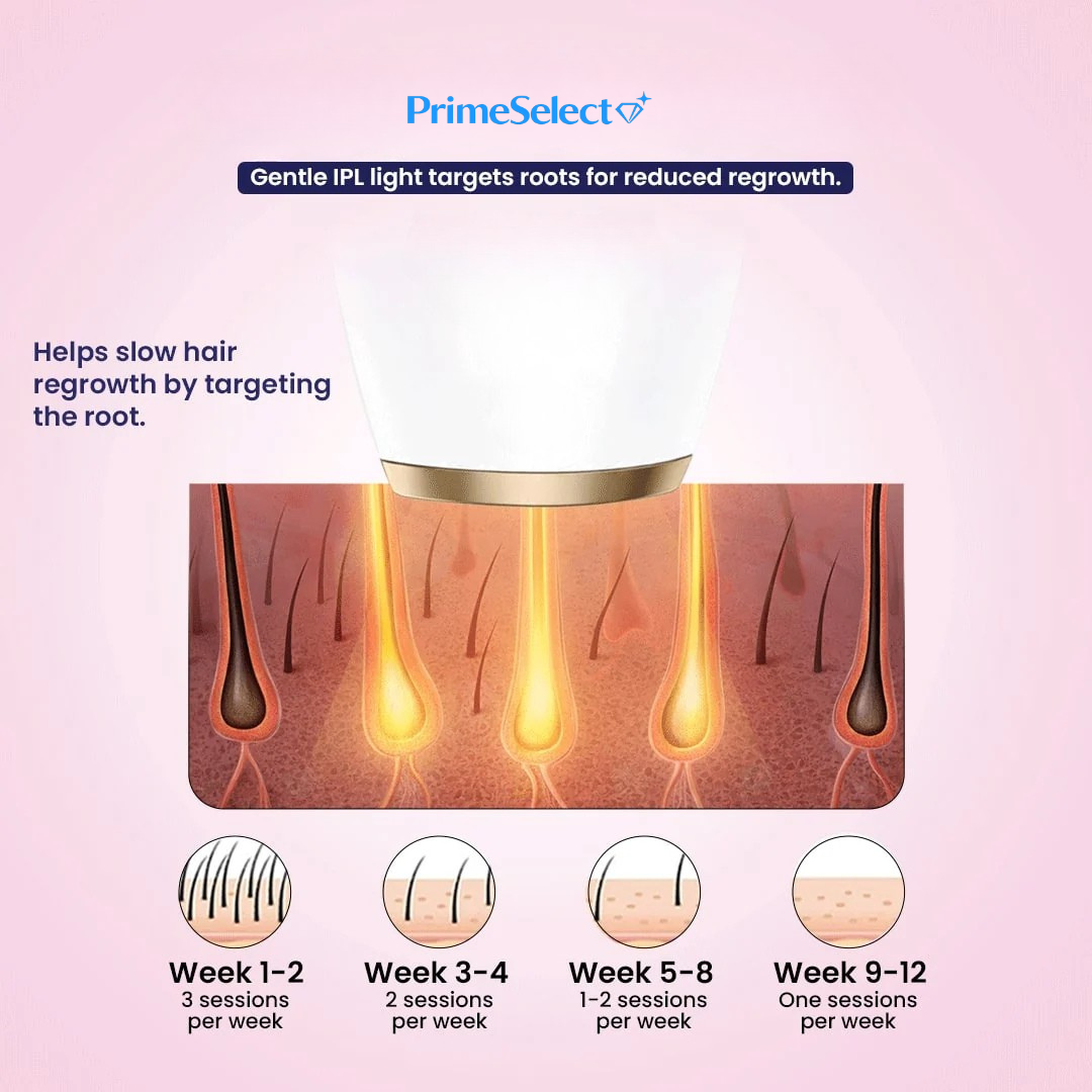 Prime Select™ SmoothHair IPL