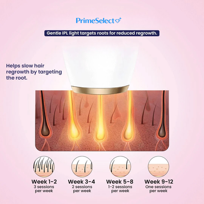 Prime Select™ SmoothHair IPL