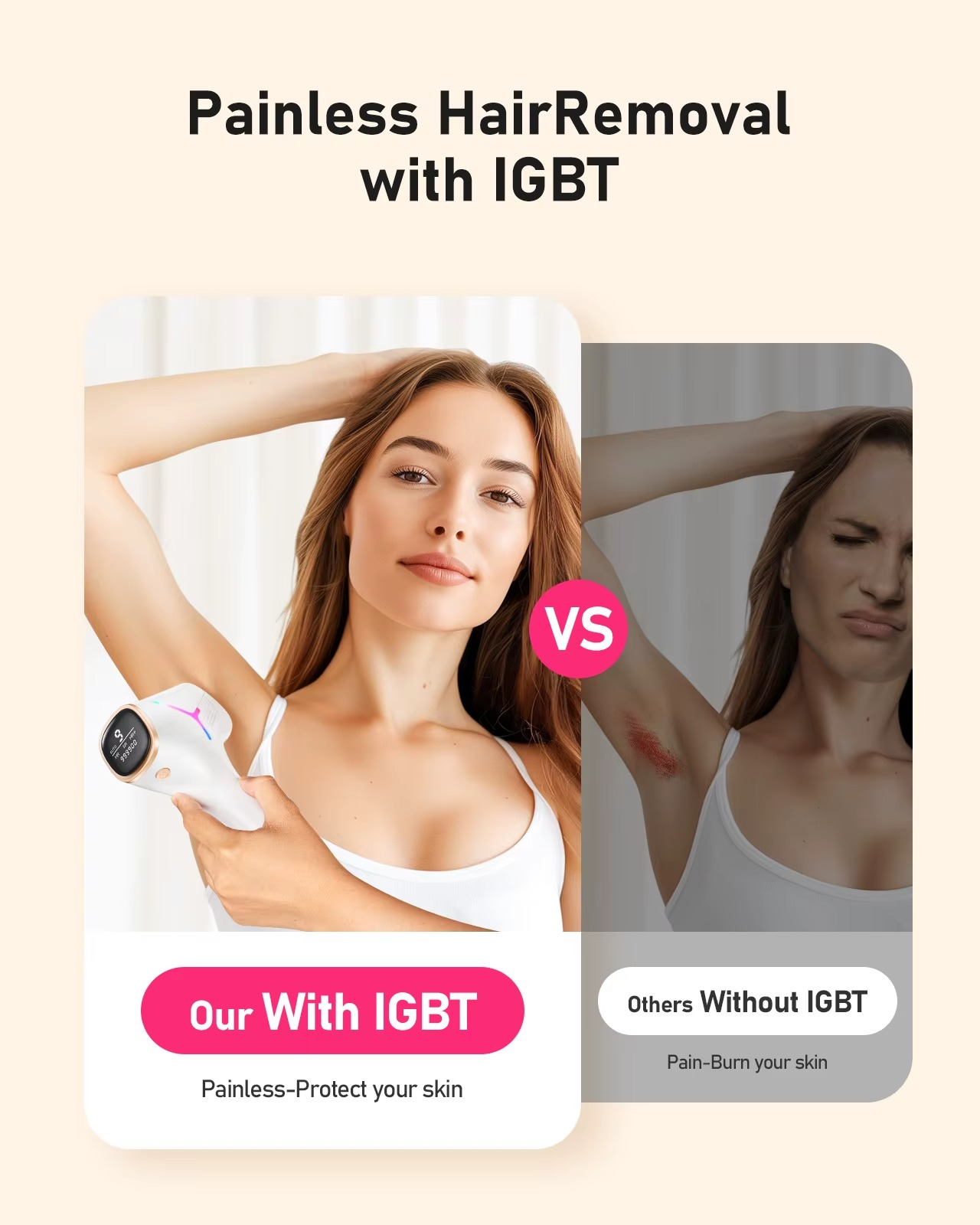 Prime Select™ SmoothHair IPL